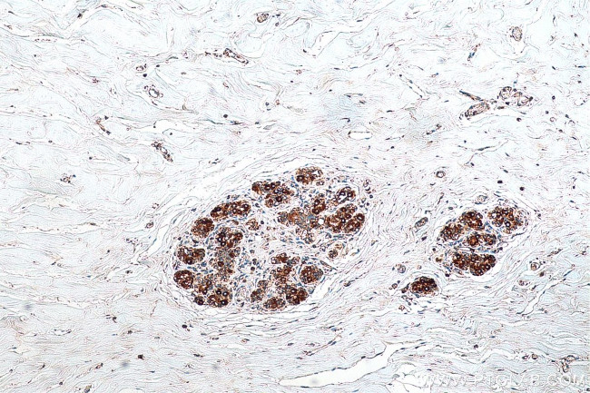 SHMT2 Antibody in Immunohistochemistry (Paraffin) (IHC (P))