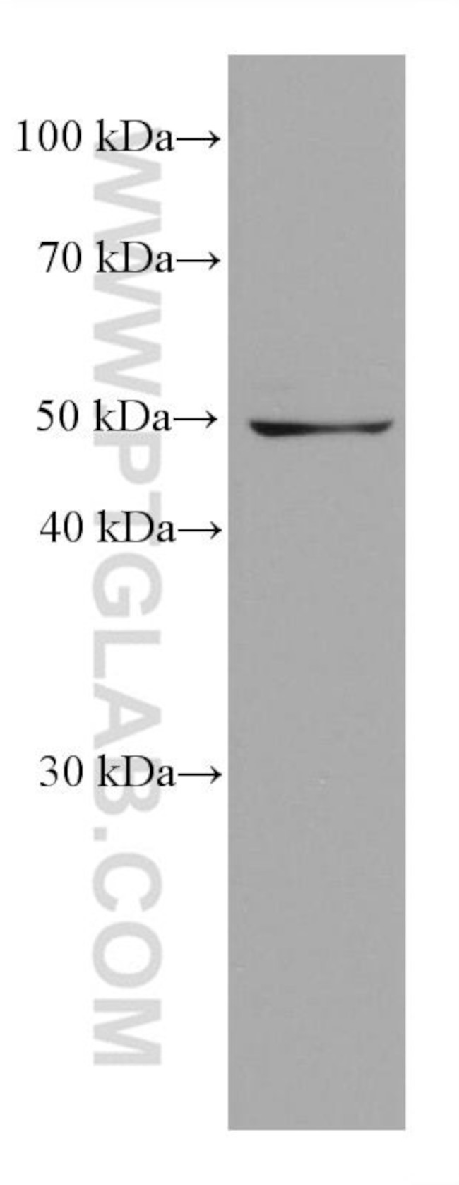 SHMT2 Antibody in Western Blot (WB)