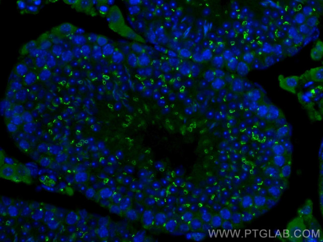 TEX14 Antibody in Immunohistochemistry (Paraffin) (IHC (P))