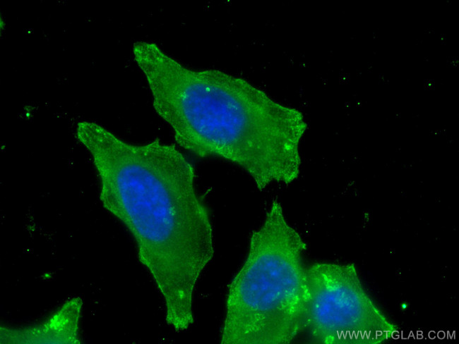 FAH Antibody in Immunocytochemistry (ICC/IF)