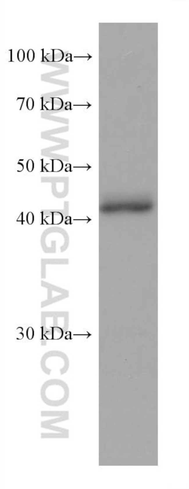 FAH Antibody in Western Blot (WB)