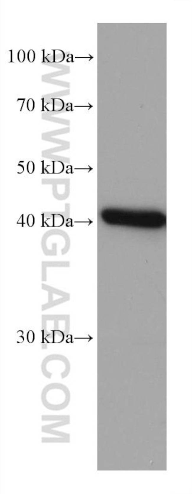 FAH Antibody in Western Blot (WB)