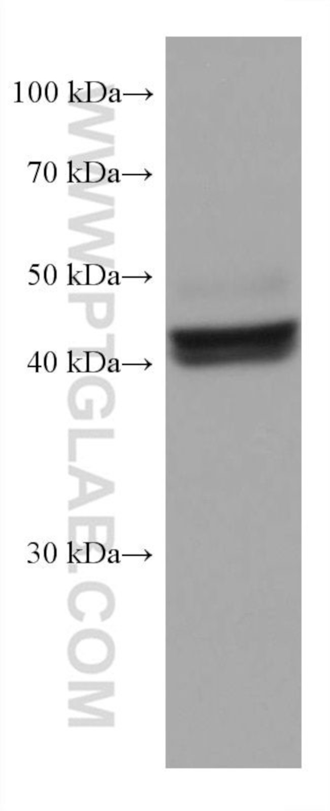 FAH Antibody in Western Blot (WB)