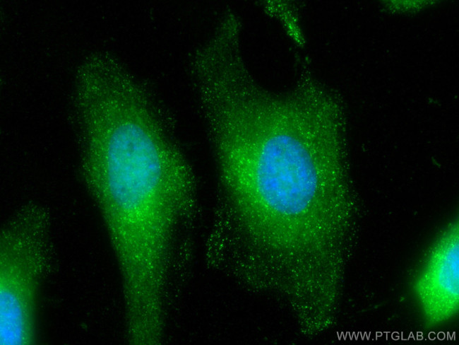 RAD23B Antibody in Immunocytochemistry (ICC/IF)