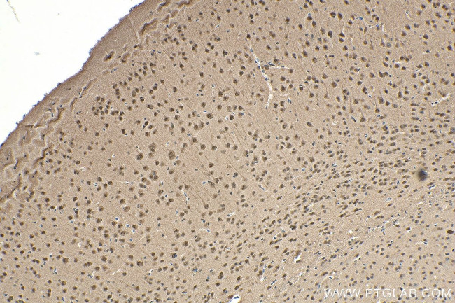 RAD23B Antibody in Immunohistochemistry (Paraffin) (IHC (P))