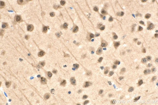 RAD23B Antibody in Immunohistochemistry (Paraffin) (IHC (P))