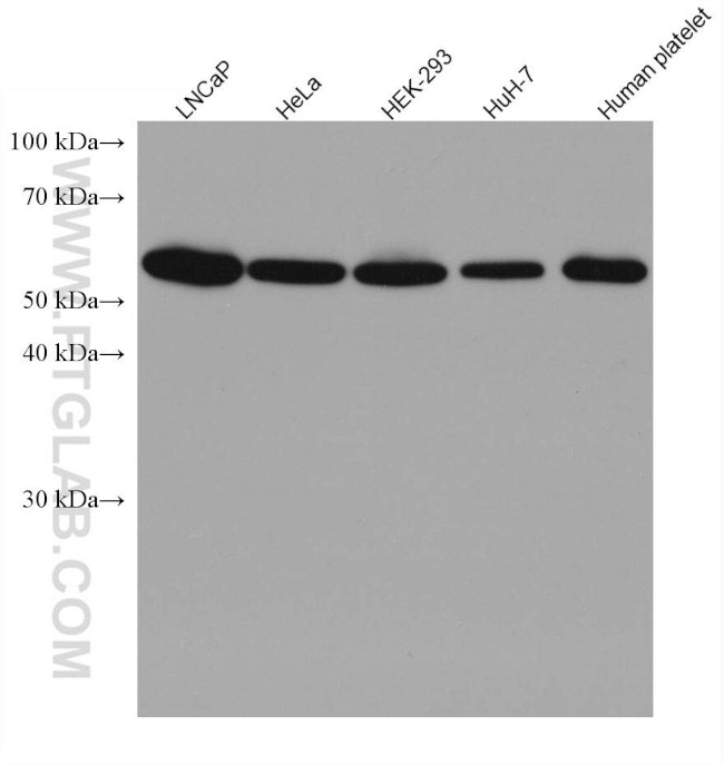 RAD23B Antibody in Western Blot (WB)