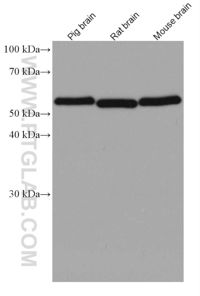 RAD23B Antibody in Western Blot (WB)