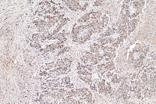 MMP7 Antibody in Immunohistochemistry (Paraffin) (IHC (P))