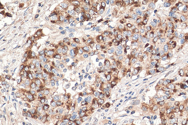 MMP7 Antibody in Immunohistochemistry (Paraffin) (IHC (P))