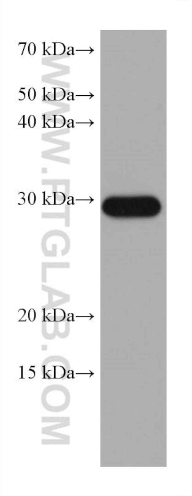 MMP7 Antibody in Western Blot (WB)