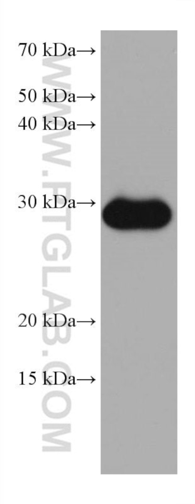 MMP7 Antibody in Western Blot (WB)