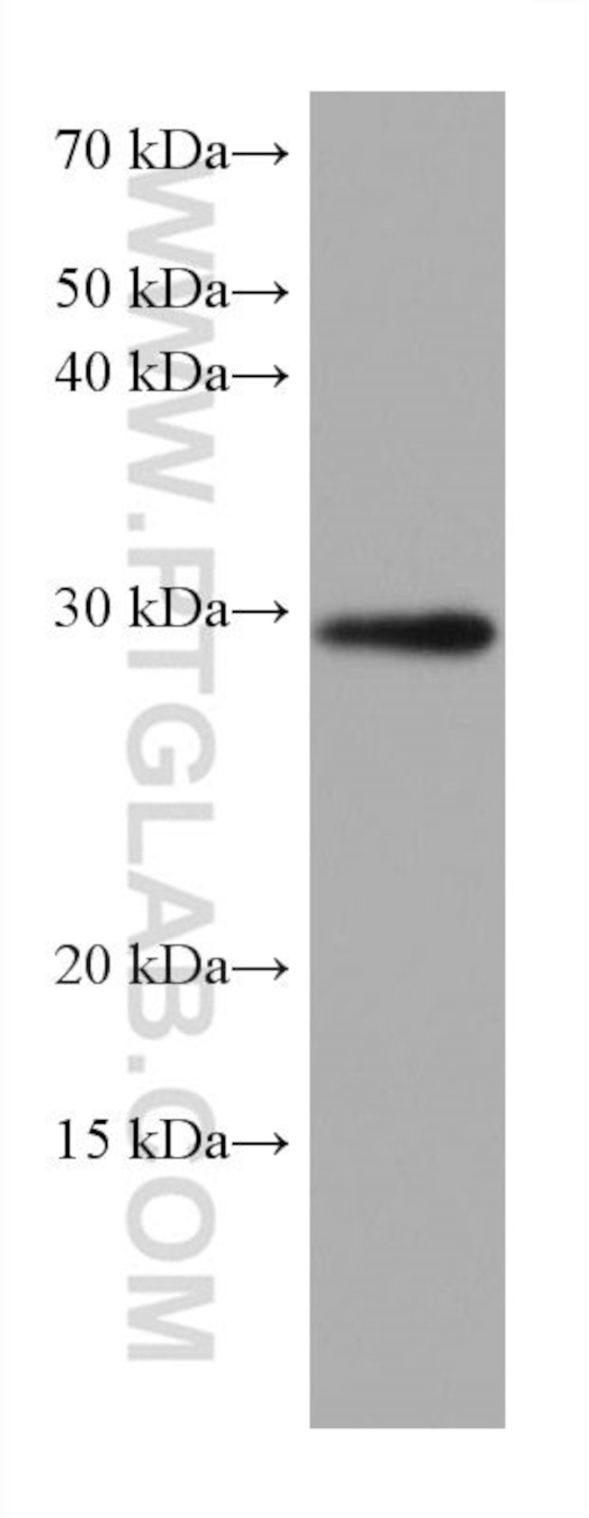 MMP7 Antibody in Western Blot (WB)