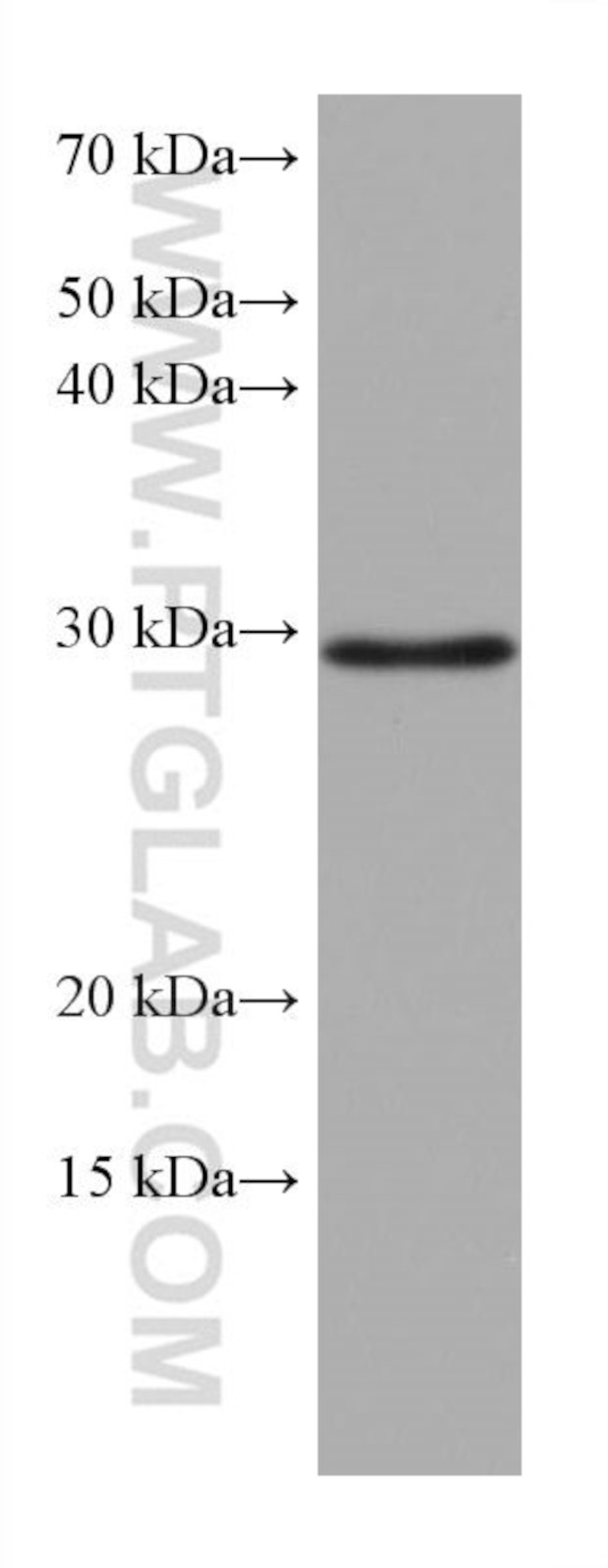 MMP7 Antibody in Western Blot (WB)