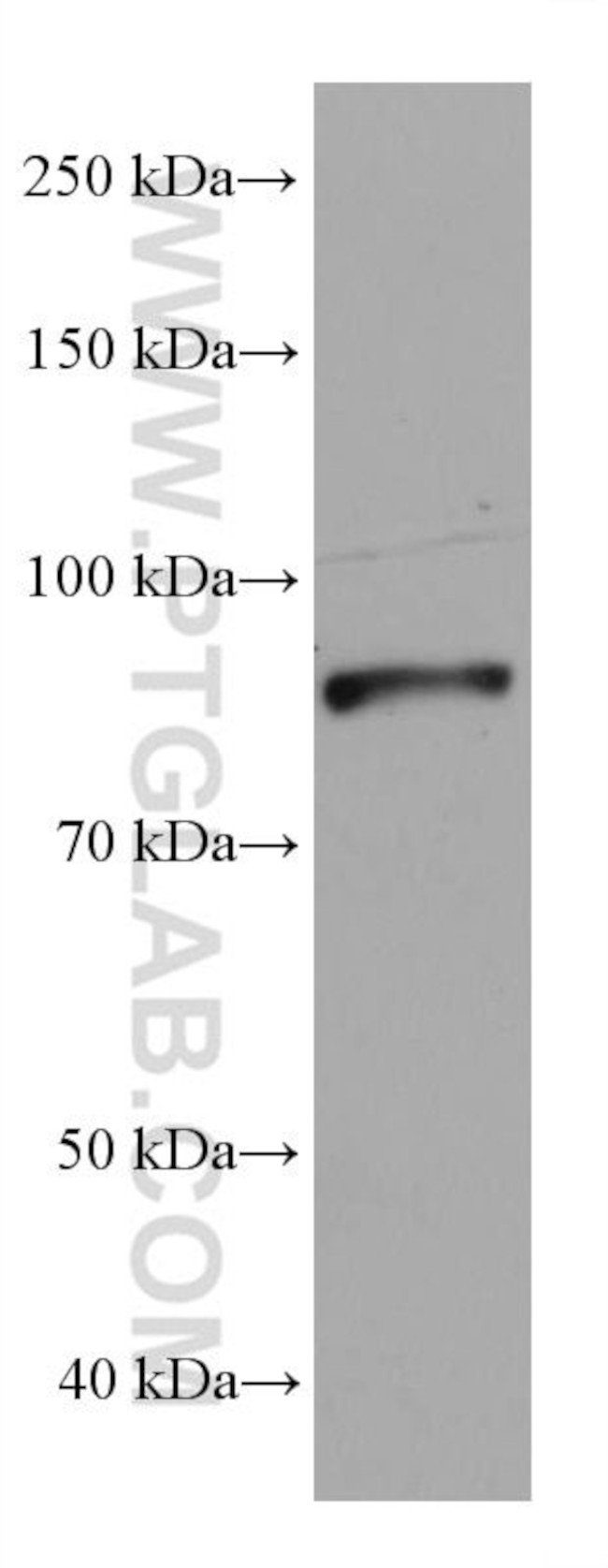 DDX1 Antibody in Western Blot (WB)