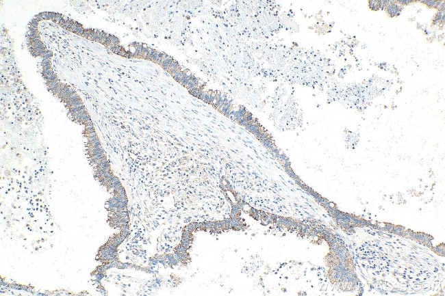 SLC30A2 Antibody in Immunohistochemistry (Paraffin) (IHC (P))