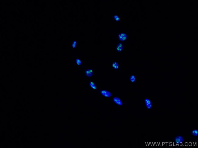 MYBBP1A Antibody in Immunocytochemistry (ICC/IF)