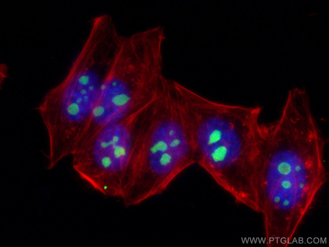 MYBBP1A Antibody in Immunocytochemistry (ICC/IF)