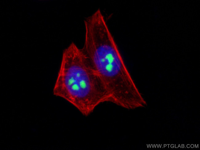 MYBBP1A Antibody in Immunocytochemistry (ICC/IF)