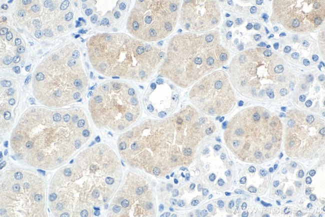 MYBBP1A Antibody in Immunohistochemistry (Paraffin) (IHC (P))