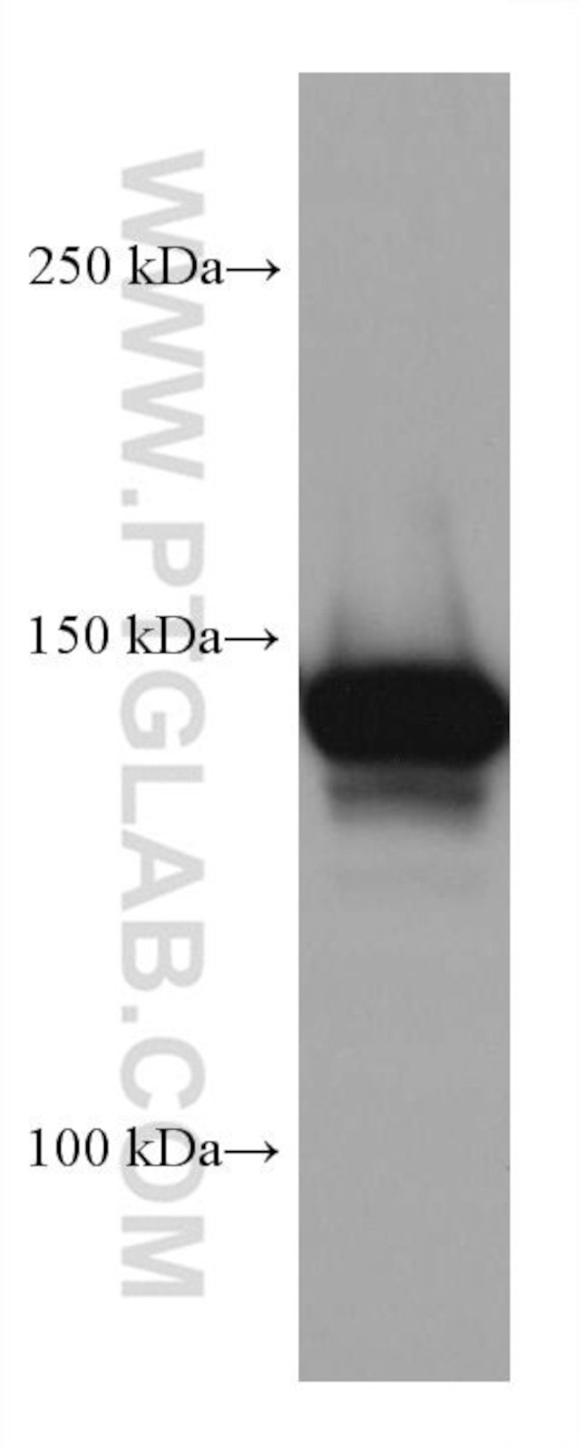 MYBBP1A Antibody in Western Blot (WB)