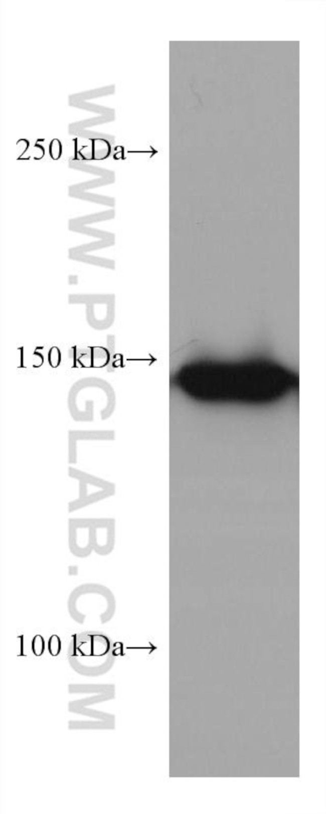 MYBBP1A Antibody in Western Blot (WB)