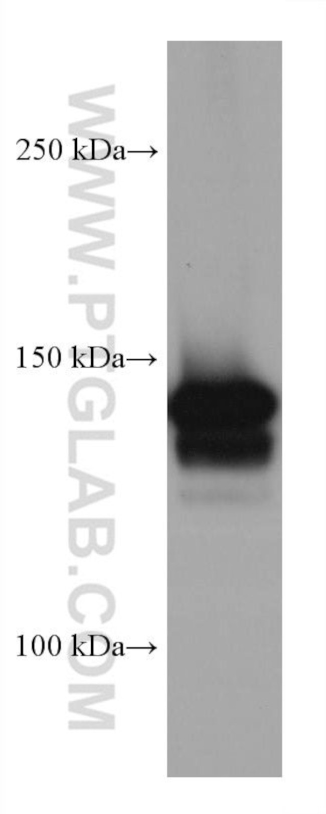 MYBBP1A Antibody in Western Blot (WB)