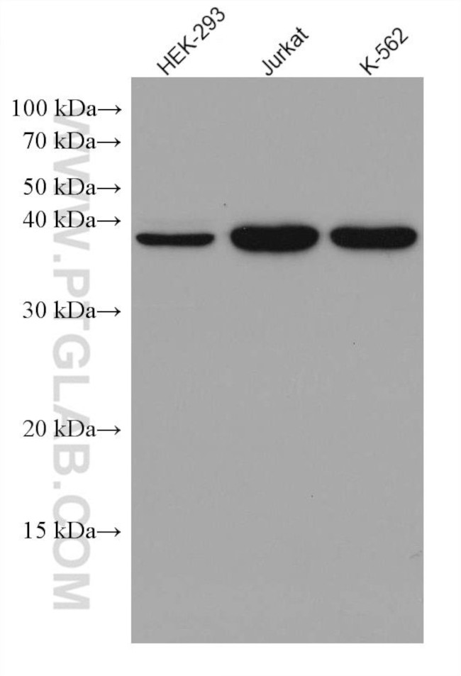 DHPS Antibody in Western Blot (WB)