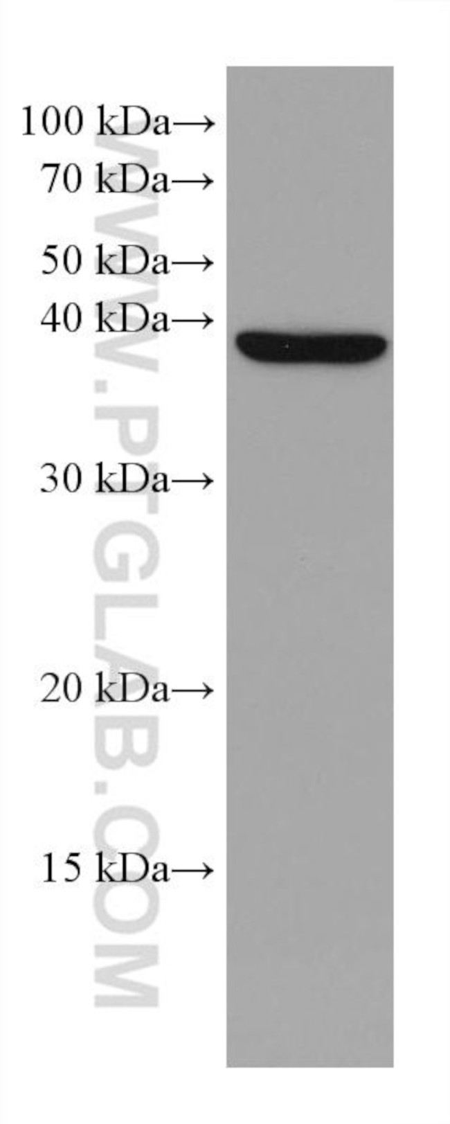 DHPS Antibody in Western Blot (WB)