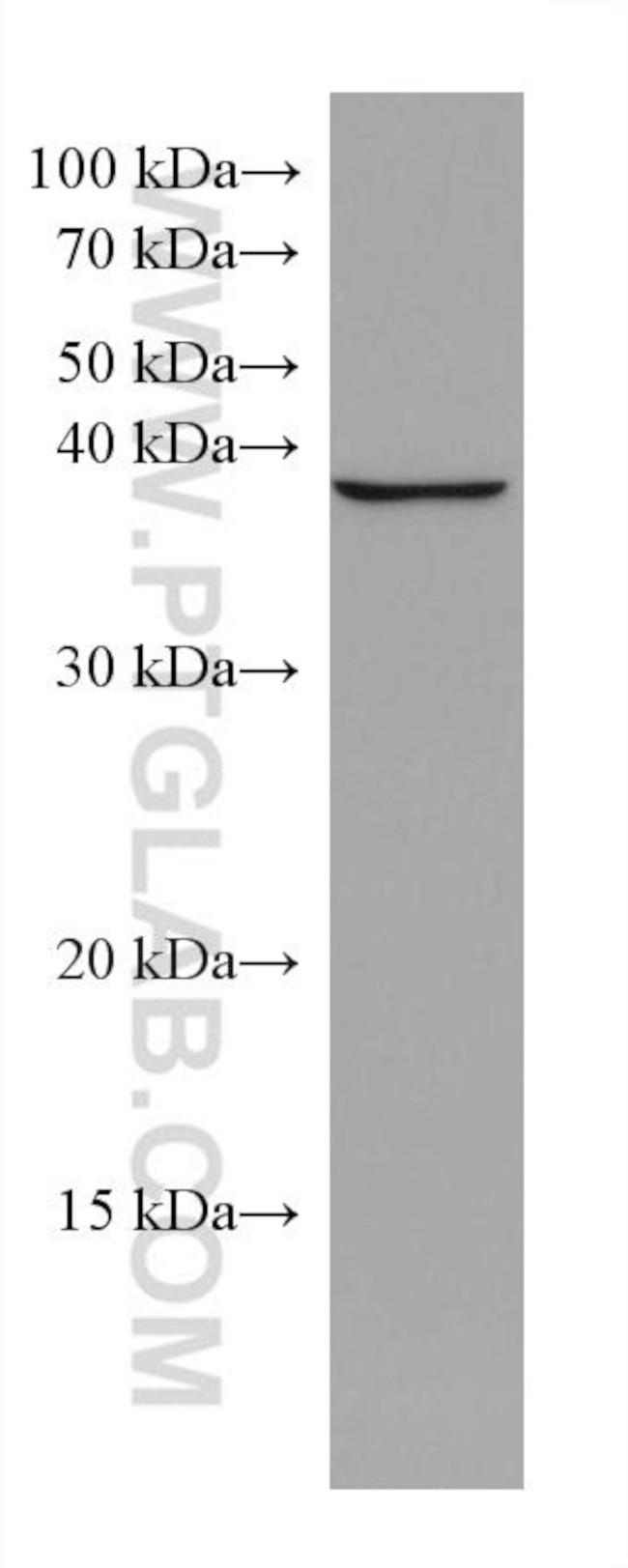 DHPS Antibody in Western Blot (WB)