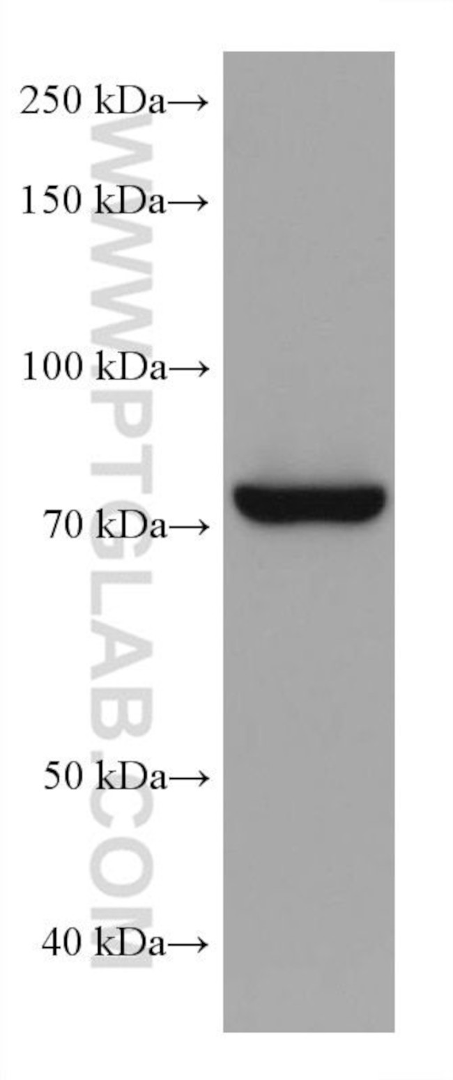 TGM2 Antibody in Western Blot (WB)