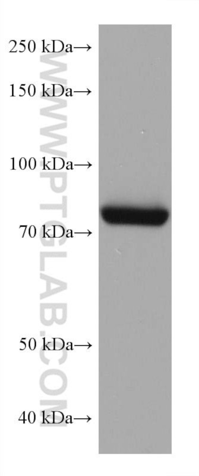 TGM2 Antibody in Western Blot (WB)