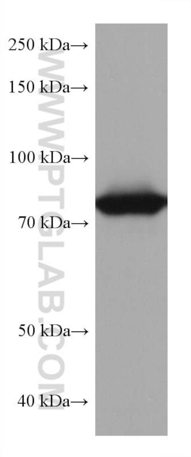 TGM2 Antibody in Western Blot (WB)