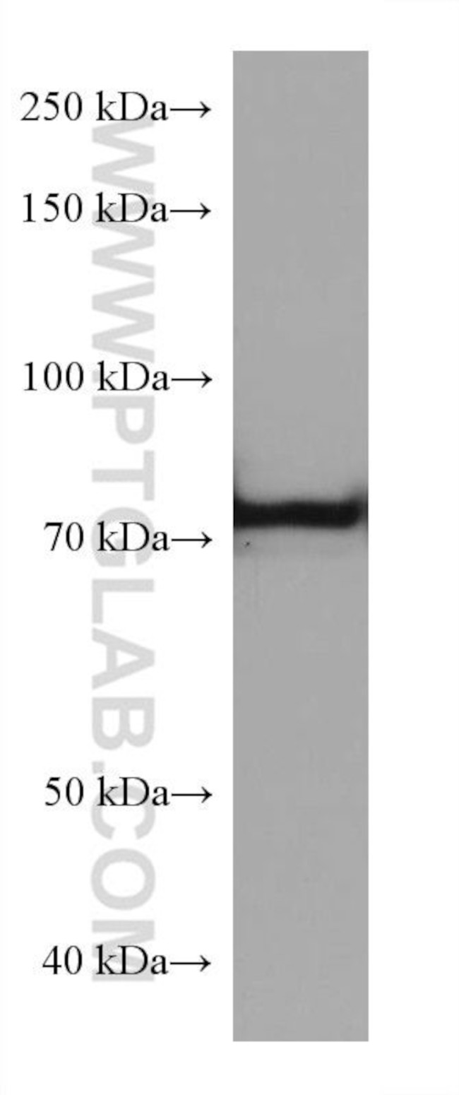 TGM2 Antibody in Western Blot (WB)