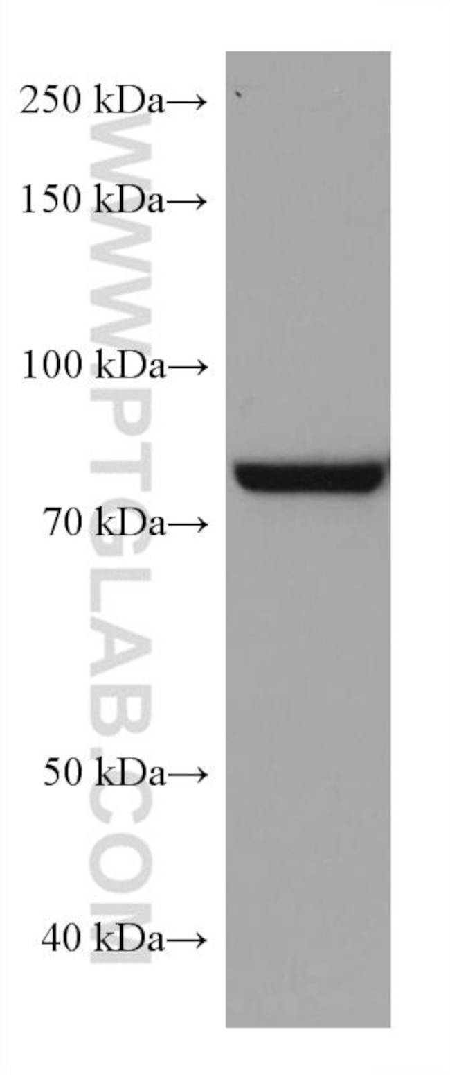 TGM2 Antibody in Western Blot (WB)