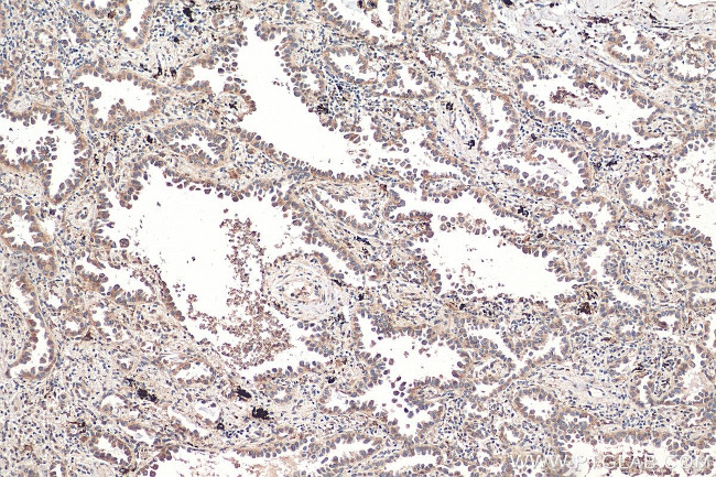 Sortilin Antibody in Immunohistochemistry (Paraffin) (IHC (P))