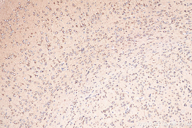 Sortilin Antibody in Immunohistochemistry (Paraffin) (IHC (P))