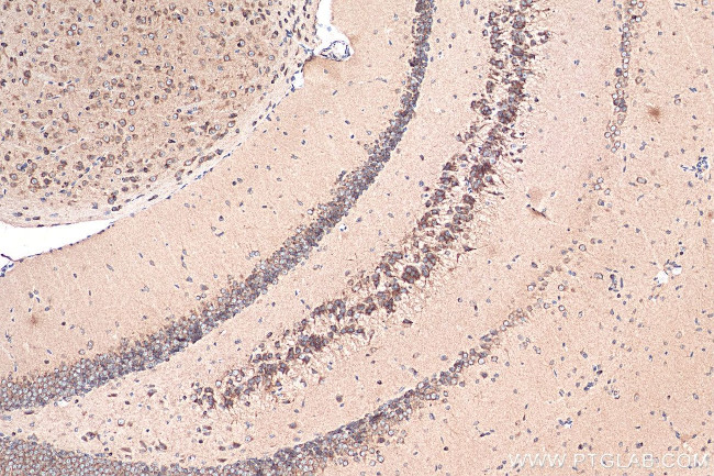 Sortilin Antibody in Immunohistochemistry (Paraffin) (IHC (P))