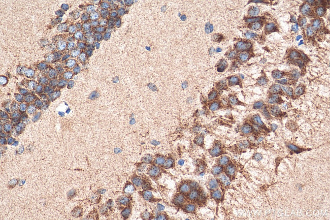 Sortilin Antibody in Immunohistochemistry (Paraffin) (IHC (P))