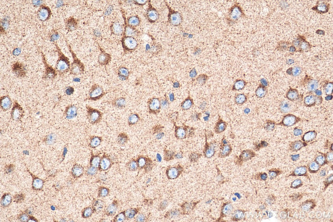 Sortilin Antibody in Immunohistochemistry (Paraffin) (IHC (P))