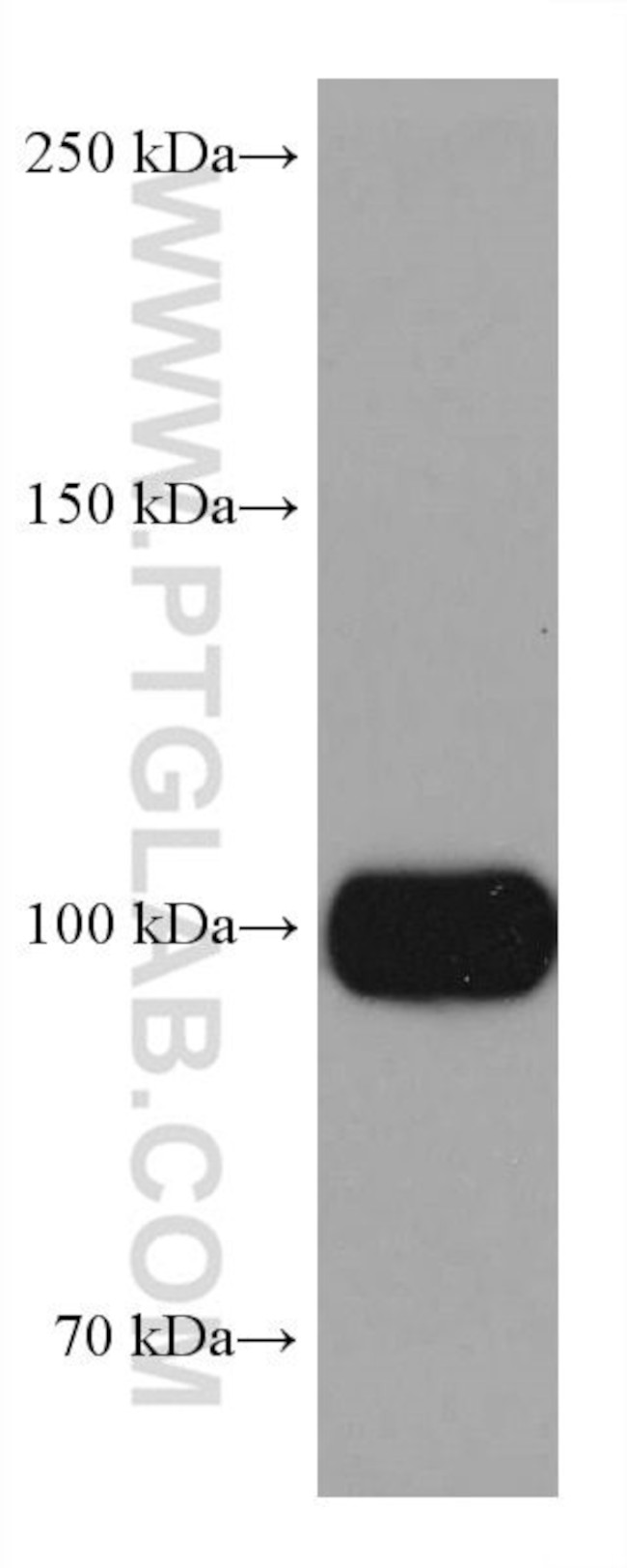 Sortilin Antibody in Western Blot (WB)