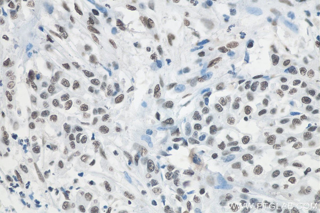 RALY Antibody in Immunohistochemistry (Paraffin) (IHC (P))