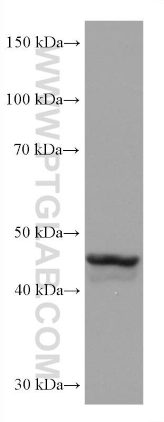 GATA4 Antibody in Western Blot (WB)