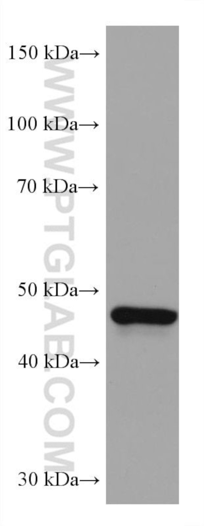 GATA4 Antibody in Western Blot (WB)