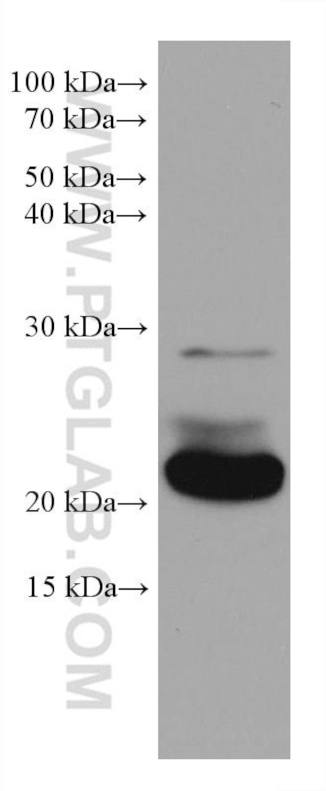 RAB39B Antibody in Western Blot (WB)