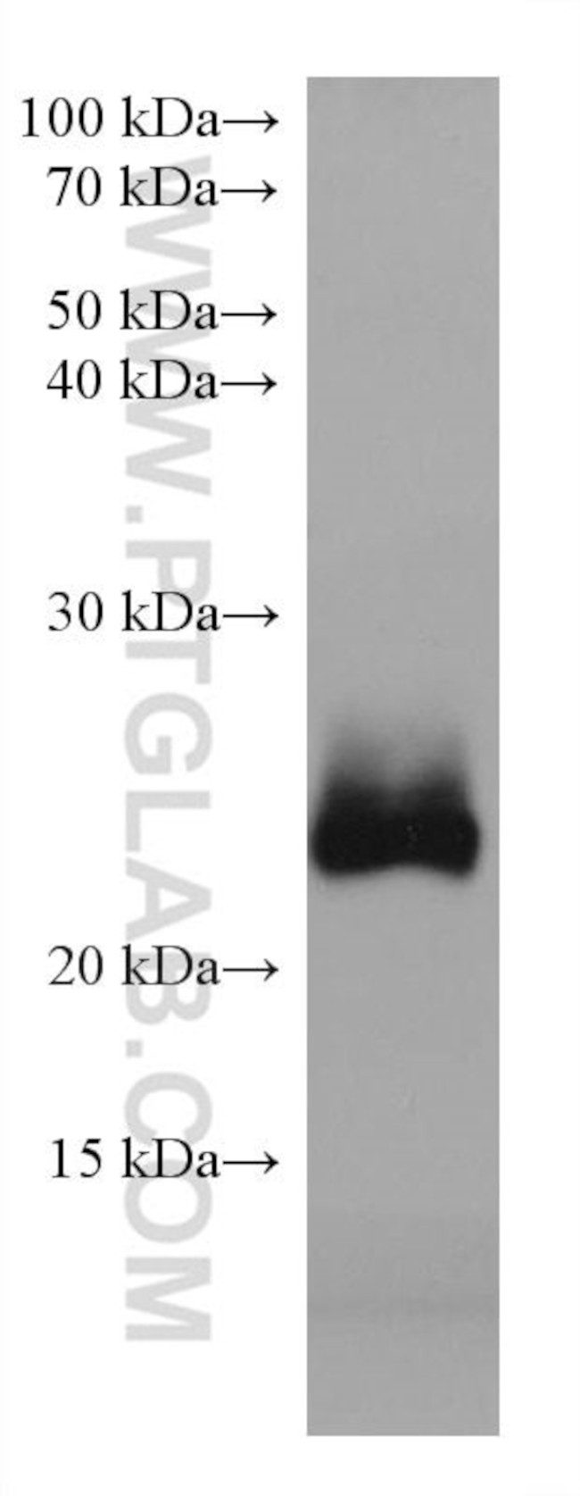 RAB39B Antibody in Western Blot (WB)