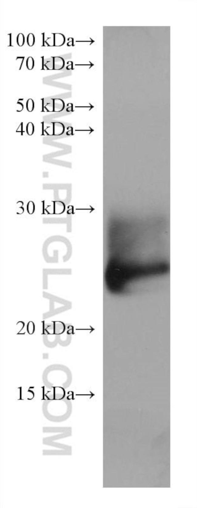 RAB39B Antibody in Western Blot (WB)