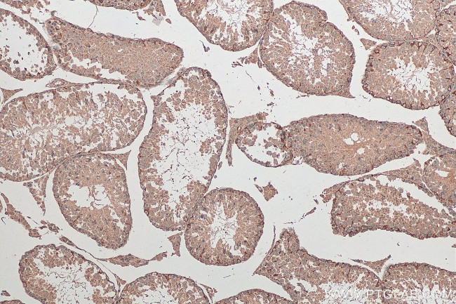 STK11 Antibody in Immunohistochemistry (Paraffin) (IHC (P))