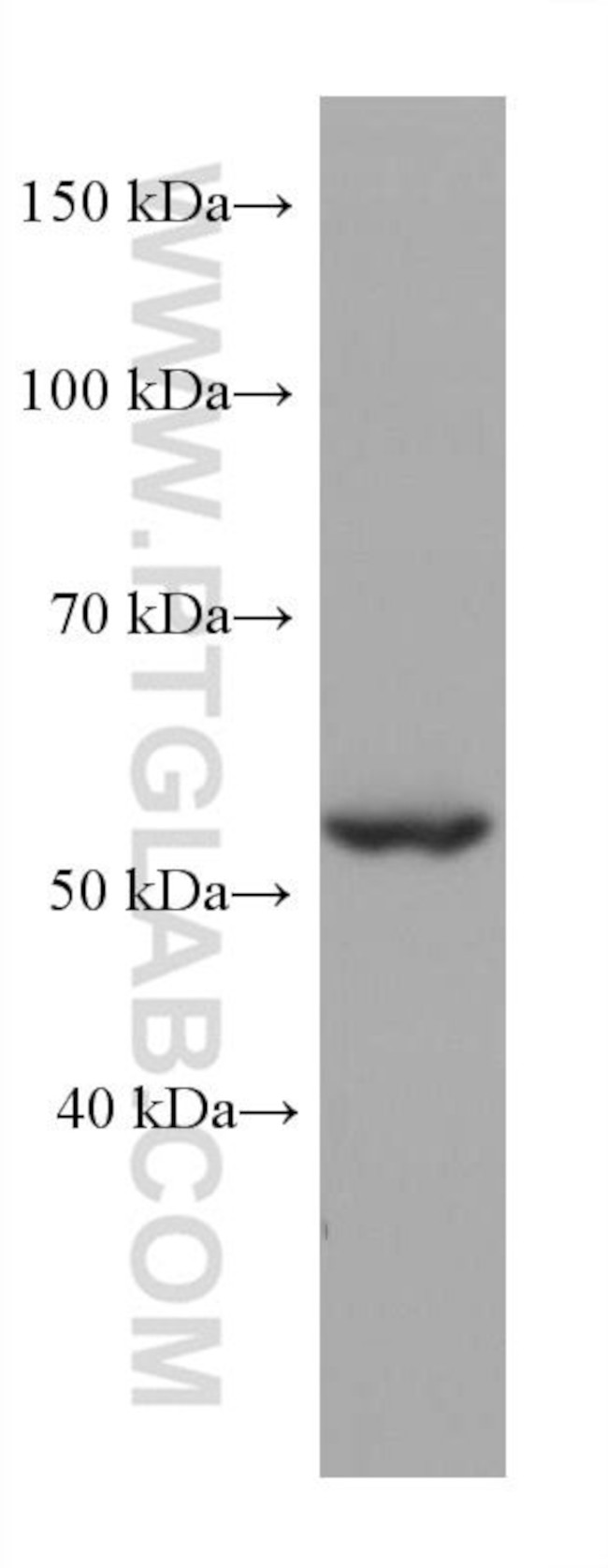 STK11 Antibody in Western Blot (WB)