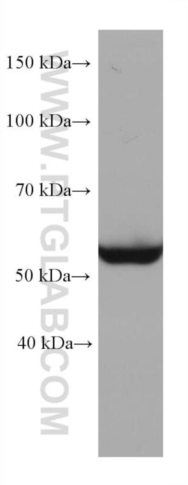 STK11 Antibody in Western Blot (WB)